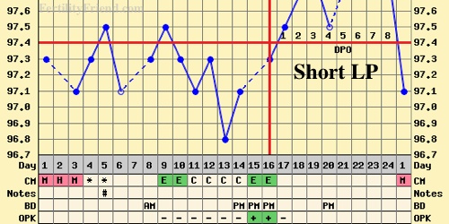 Short luteal phase