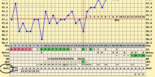 Pcos Bbt Chart